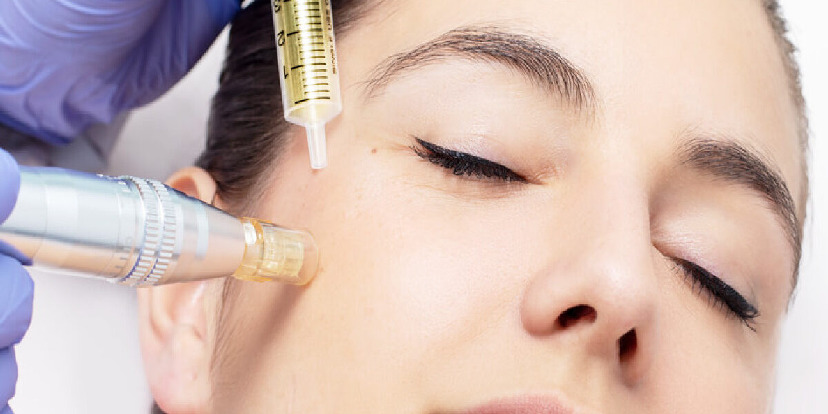 How Long Does a Mesotherapy Session Take?