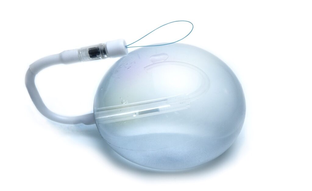 Gastric Balloon Procedure in Dubai