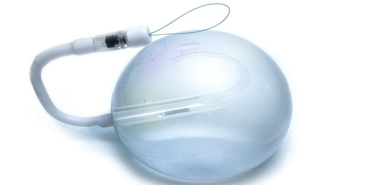 Exploring Non-Surgical Weight Loss: The Gastric Balloon Procedure in Dubai
