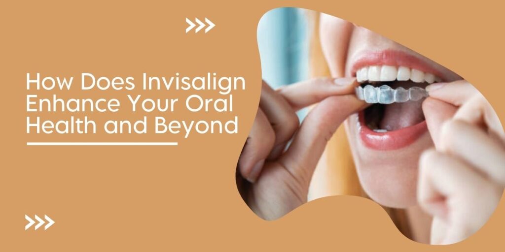 Invisalign