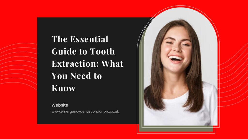 Tooth Extraction