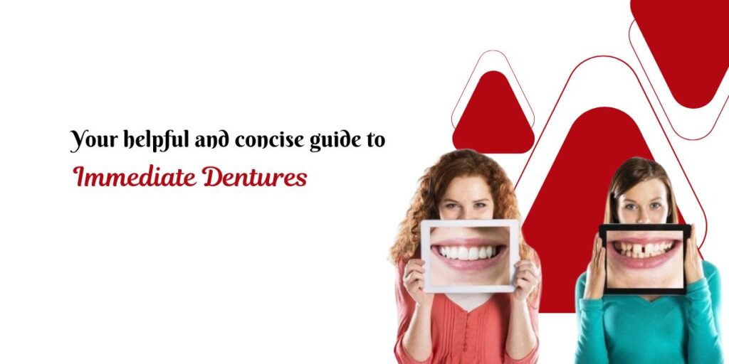 immediate dentures